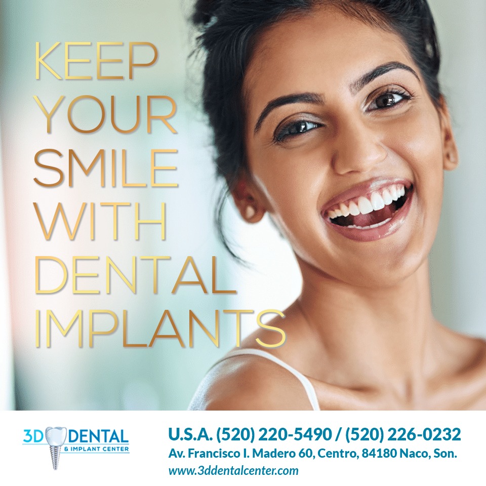 naco-dental-implants-3ddental-960x960px